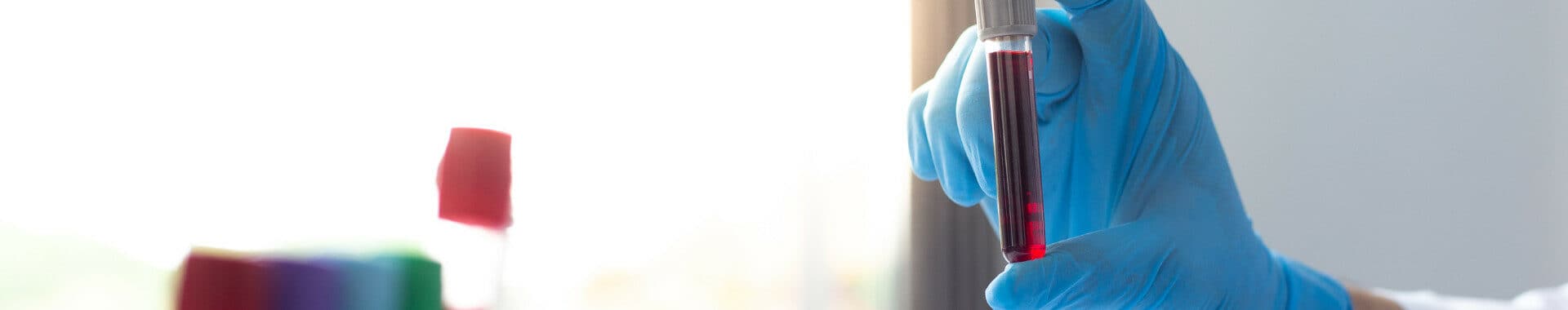 blood testing in essex banner image vie aesthetics