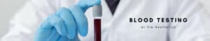 menopause clinic in London blood testing banner vie aesthetics