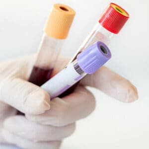 Blood Testing | Reasons, Benefits & Packages