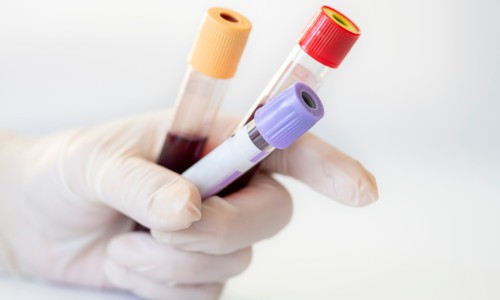 Blood Testing | Reasons, Benefits & Packages