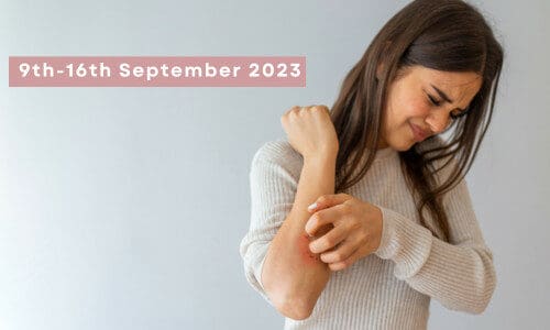 National Eczema Awareness Week 2023