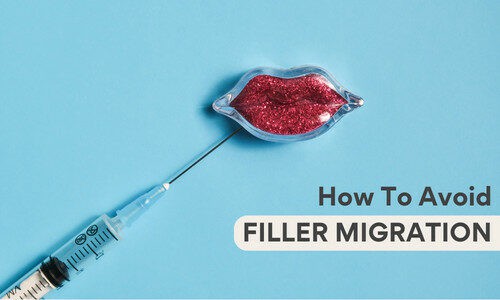 Lip Filler Migration: Causes & Prevention