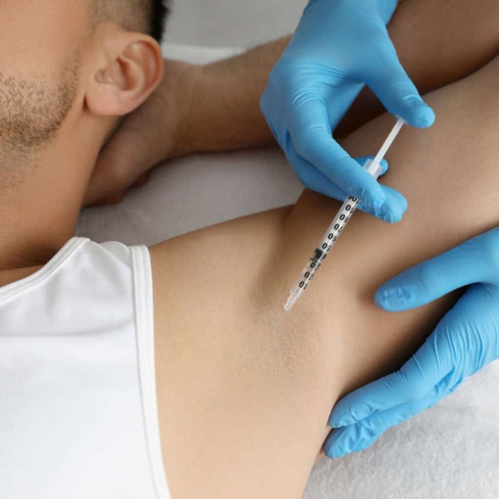 hyperhidrosis: causes symptoms and treatment vie aesthetics rayleigh essex holborn london excessive sweating
