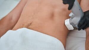 Hifu Body Contouring 