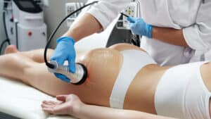 RF Skin tightening Body Sculpting 