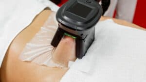 Fat Freezing Body Contouring