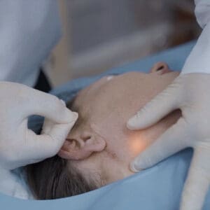Considering Endolift? Key Facts and Considerations