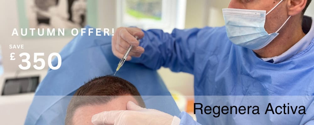 autumn offer £350 off hair loss treatment vie aesthetics