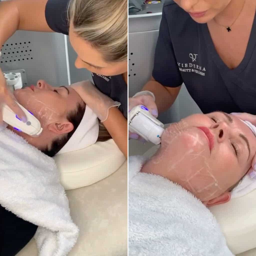 hifu skin tightening at vie aesthetics rayleigh essex holborn london hifu for face and body