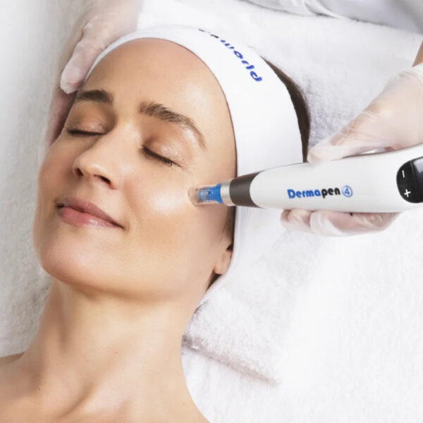 Microneedling with Dermapen 4™