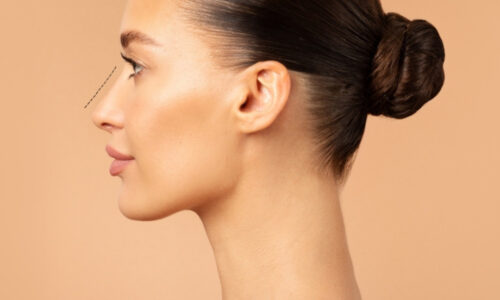 Non-Surgical Nose Jobs: What Can Be Achieved with Fillers?