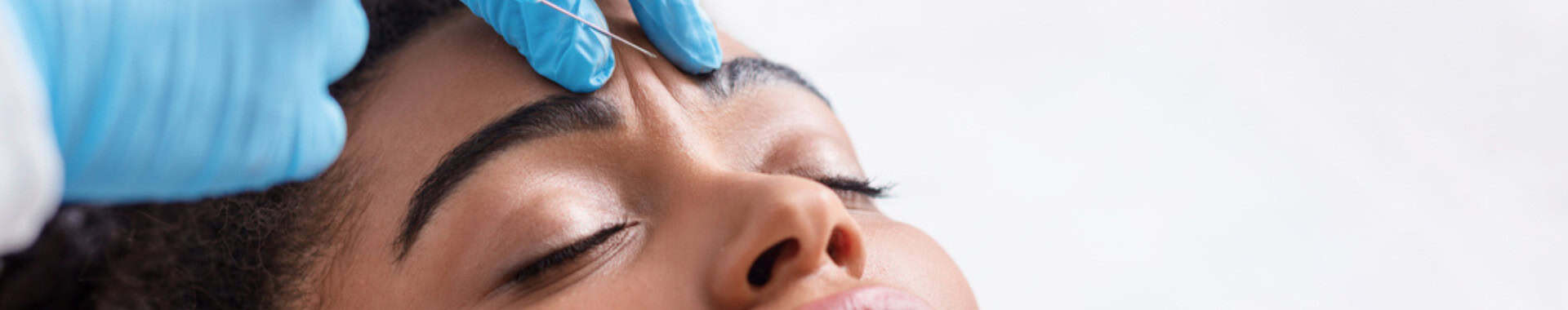 Botox for Migraines – How Effective Is It?