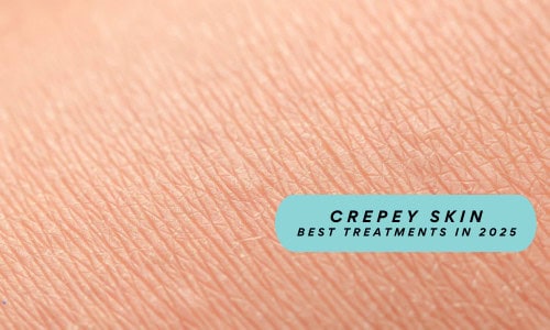 Best Treatments for Crepey Skin in 2025