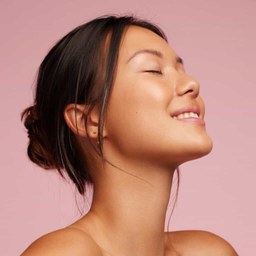 clear skin after acne scarring treatment microneedling dermapen 4 vie aesthetics rayleigh essex holborn london How to Fade Acne Scars This Summer Without Harsh Treatments