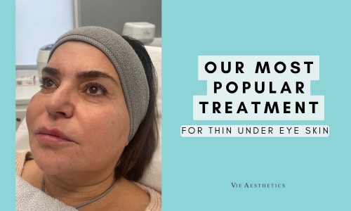 Thin Under Eye Skin: Treatment Options