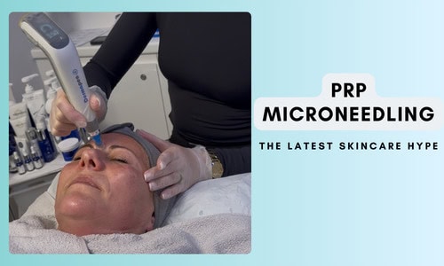 PRP Microneedling: How Does It Work?