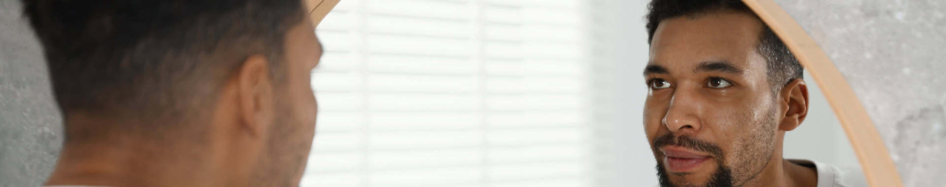 receding hairline treatments uk vie aesthetics rayleigh essex holborn london regenera activa prp polynucleotides