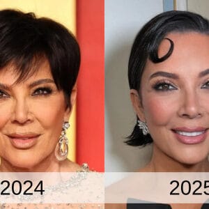 Kris Jenner Facelift Regret: What Can We Learn About Natural Results?