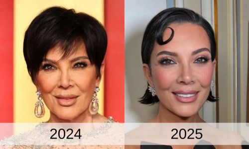 Kris Jenner Facelift Regret: What Can We Learn About Natural Results?