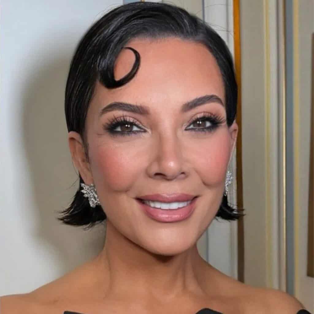 kris jenner facelift vie aesthetics rayleigh essex holborn london