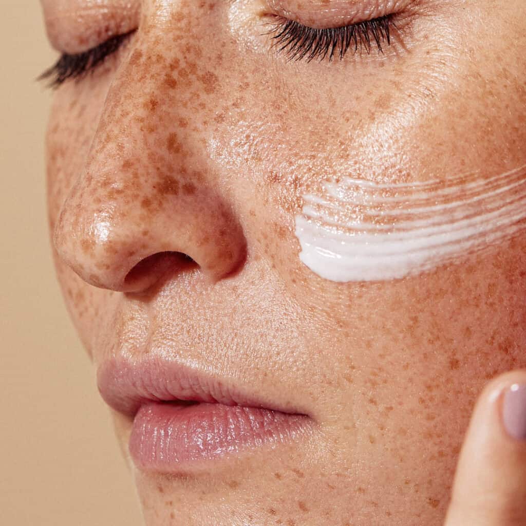 skin pigmentation vs sun damage vie aesthetics rayleigh essex holborn london