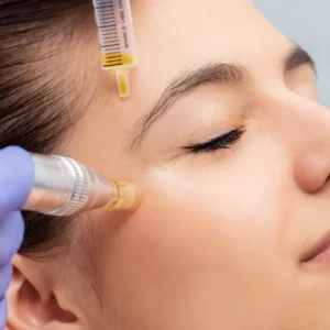 The Ultimate Guide to PRP Treatment: How Regenerative Medicine Works for You