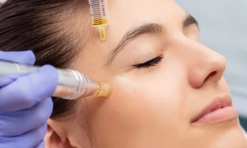 PRP Treatment: How Regenerative Medicine Works for You