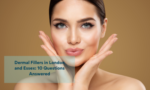 Dermal Fillers in London and Essex: 10 Questions Answered